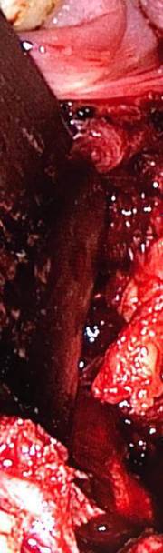 Photos of Minimal Access ENT Surgery Minimal access ENT surgery